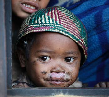 <b>Madagascar, Countryside</b>, The look of a small child